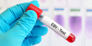 Masterclass online - Infecciones por el virus de Epstein-Barr (VEB) (3 partes) @ Madrid | Comunidad de Madrid | España